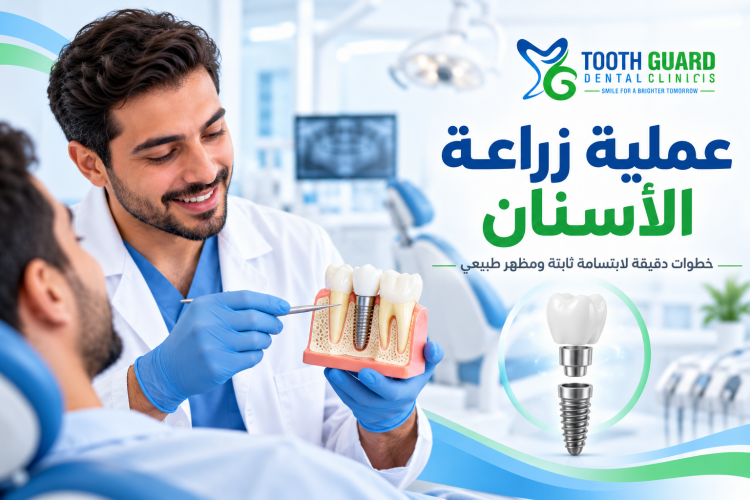 دليلك المبسط لفهم عملية زراعة الأسنان ونسبة نجاحها